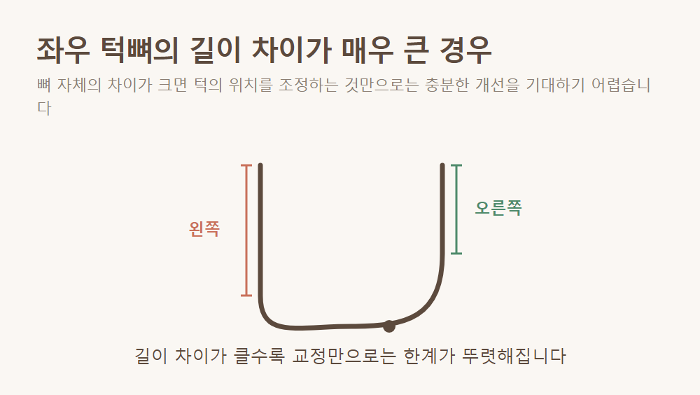 좌우 턱뼈의 길이 차이가 매우 큰 경우