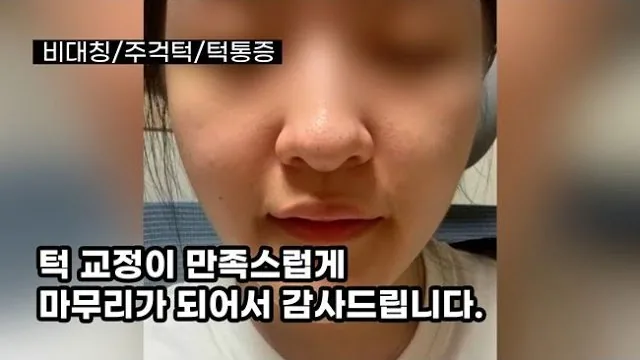 턱교정을 마친 분의 인터뷰 영상